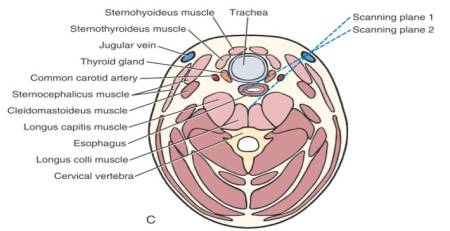 anatomie_-_schilddruese_ultraschall_matoon_2015_.jpg