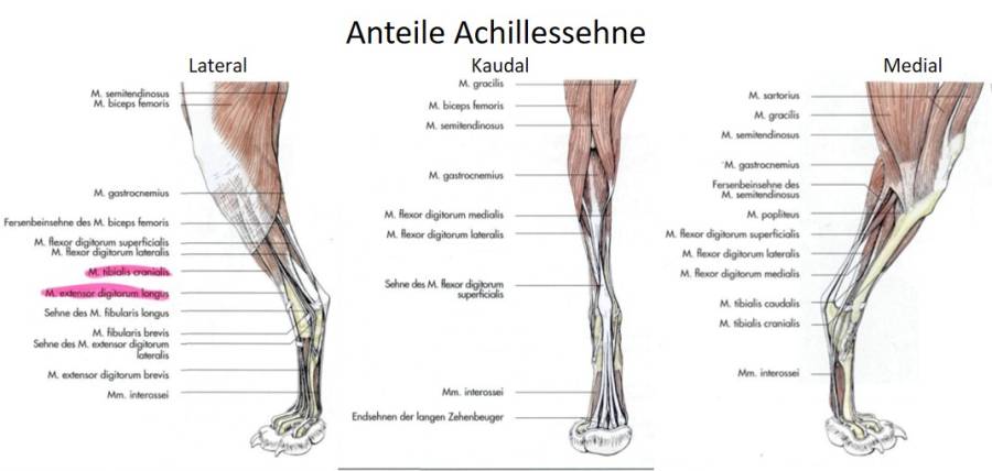 anteile_achillessehne.jpg