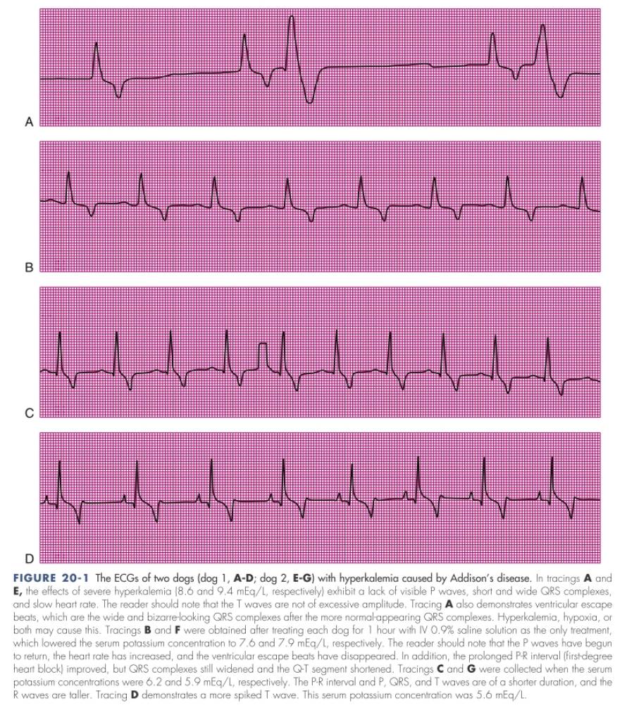 ekg_-_hyperkaliaemie_battaglia_2016_.jpg