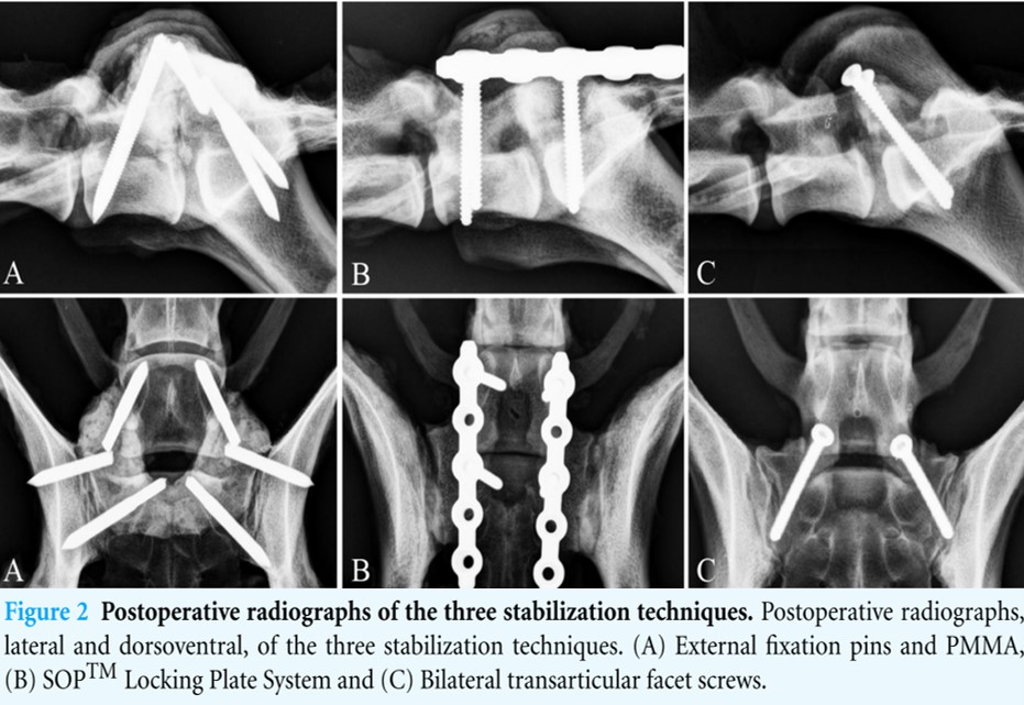 neurochirurgie_-_ces_stabilisierung_2_early_et_al._2015_.jpg