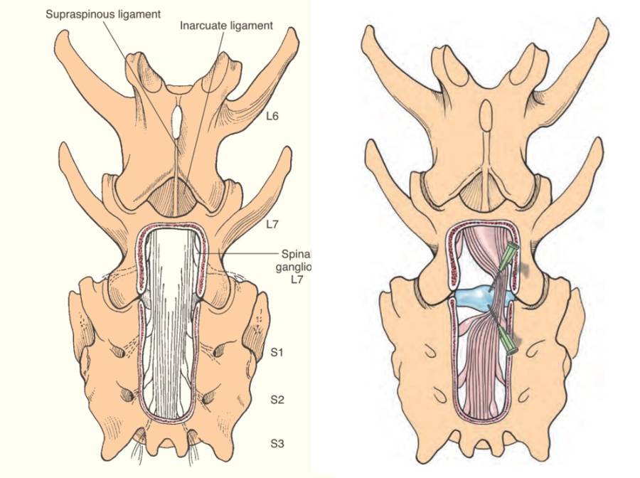 neurochirurgie_-_dorsale_laminektomie_ces_fossum_2013_.jpg