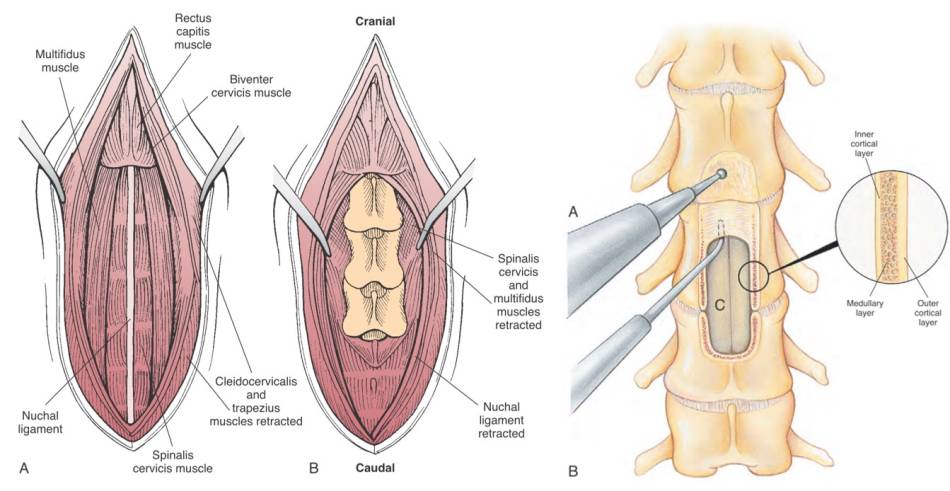 neurochirurgie_-_dorsale_laminektomie_hws_fossum_2013_.jpg