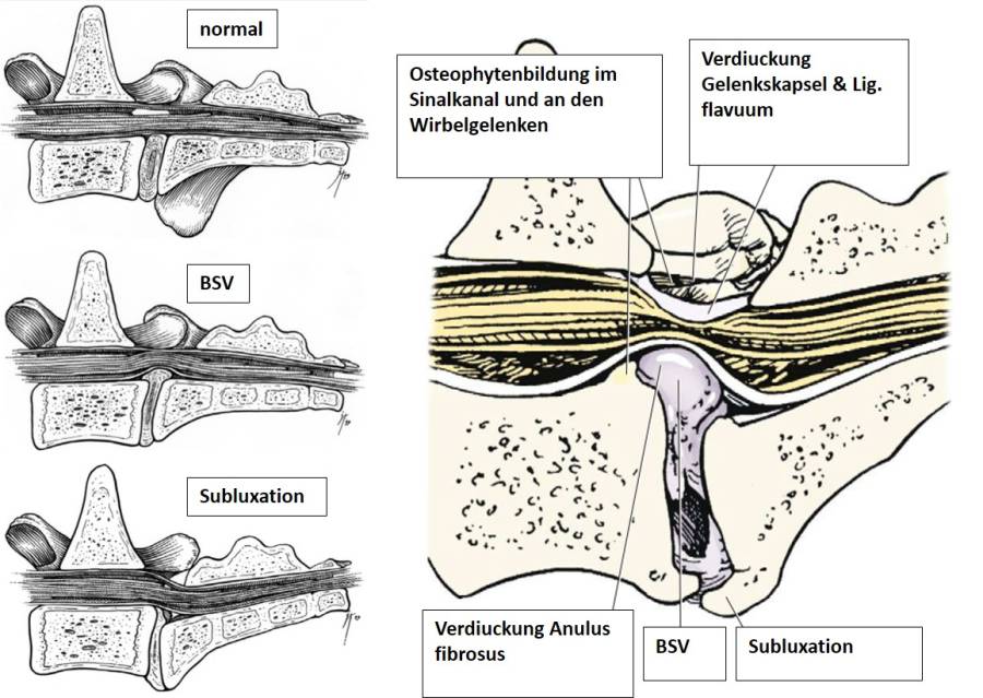 neurochirurgie_-_ursachen_cauda-equina_1_sharp_wheeler_2005_.jpg