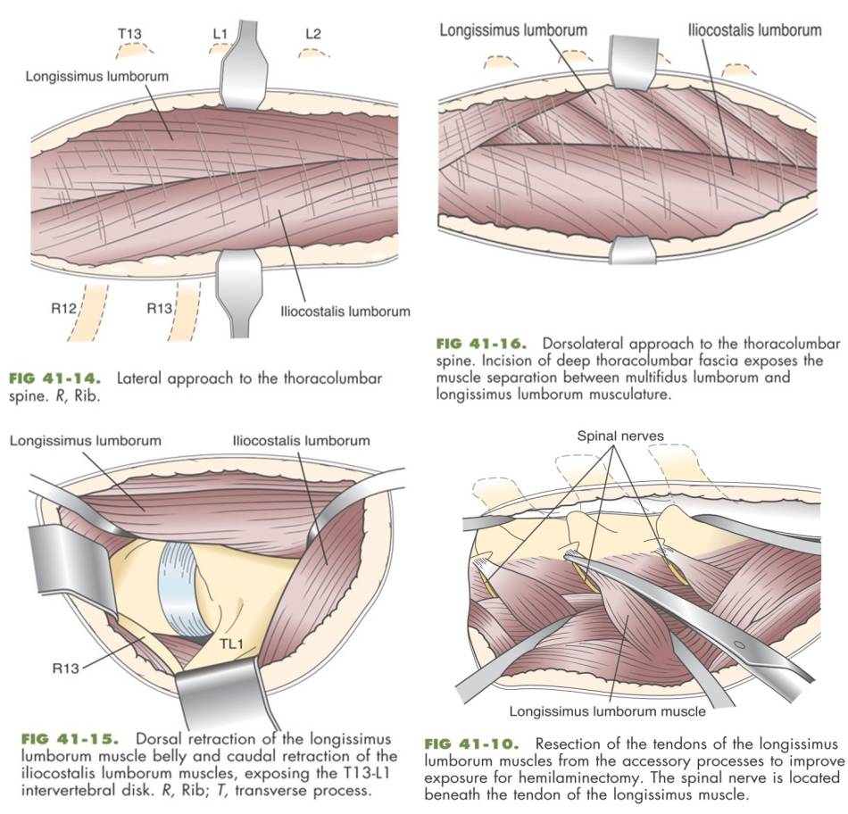 neurochirurgie_-_zugang_hemilaminektomie_korpektomie_fossum_2013_.jpg