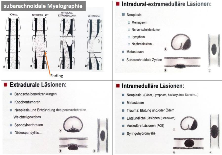 neurologie_-_myelographie_bei_raumforderung.jpg