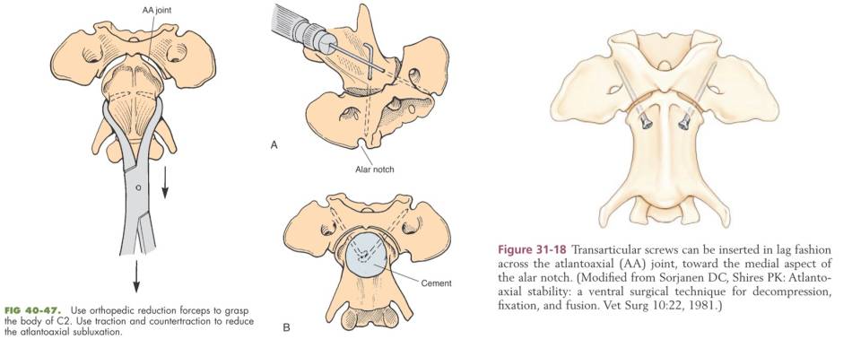 op_-_atlantoaxiale_subluxation_-_transartikulaere_verschraubung_tobias_2012_fossum_2013_.jpg