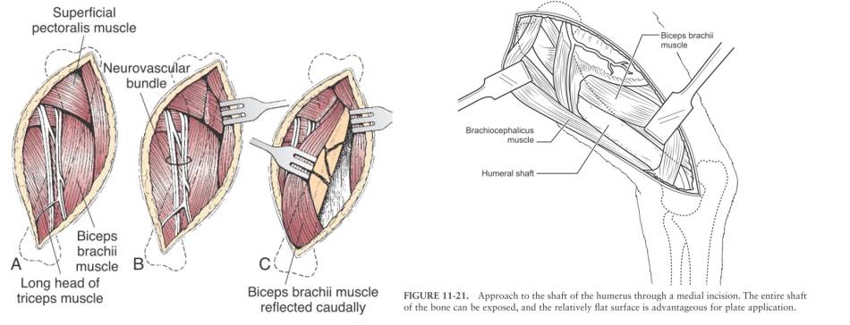op_-_humerus_-_medialer_zugang_fossum_2013_permattei_2017_.jpg