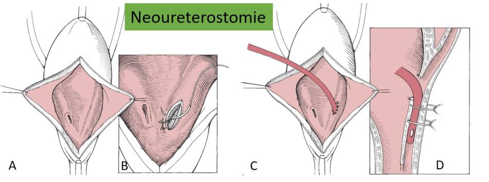 op_-_neoureterostomie_fossum_2013_.jpg