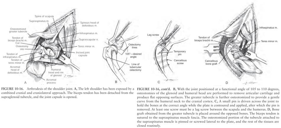 op_-_schulterarthrodese_decamp_et_al._2016_.jpg