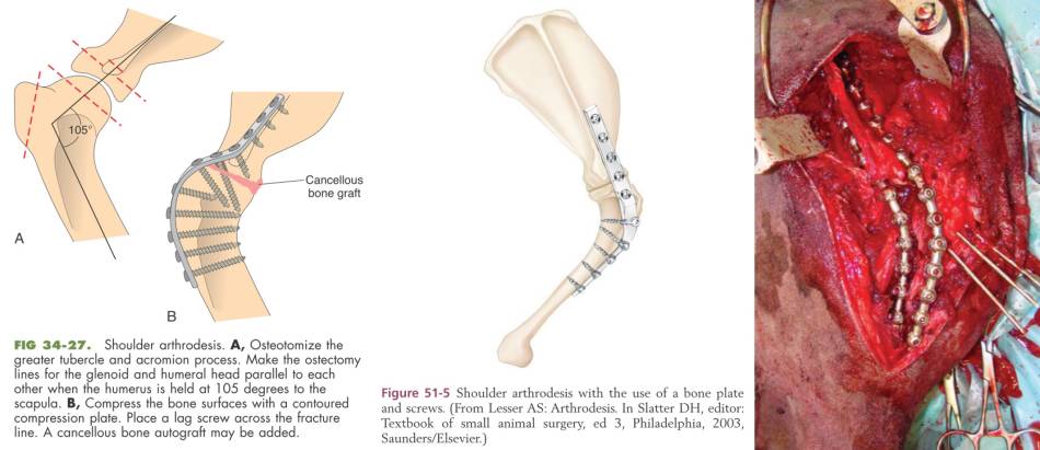 op_-_schulterarthrodese_fossum_2013_tobias_johnston_2012_fitzpatrick_et_al._2010_.jpg
