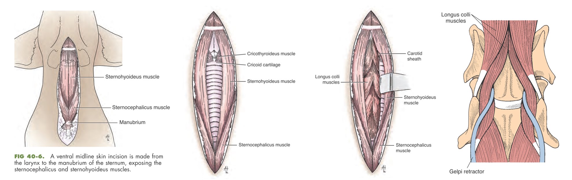 op_-_zugang_ventral-slot_fossum_2013_.jpg