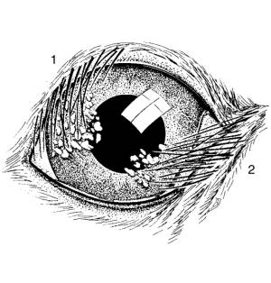 ophthalmologie_-_trichiais_schema_stades_et_al._2007_.jpg