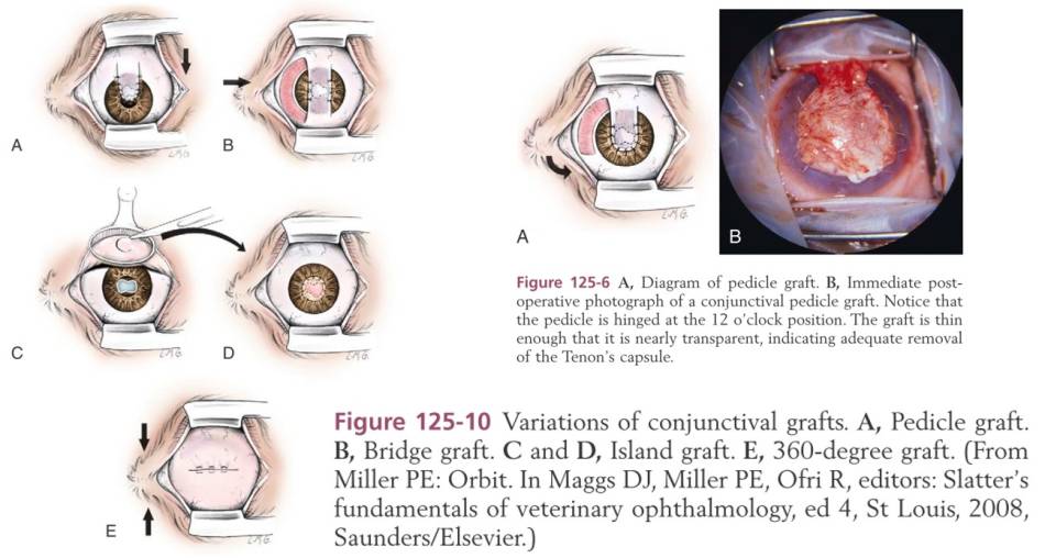 ophthalmologie_op_-_konjunktival-flap_tobias_johnston_2012_.jpg