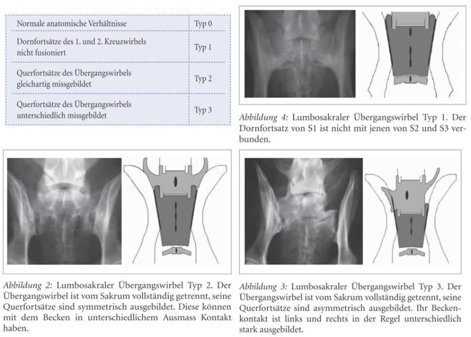 orthopaedie_-_uebergangswirbel_typen_flueckiger_et_al._2009_.jpg