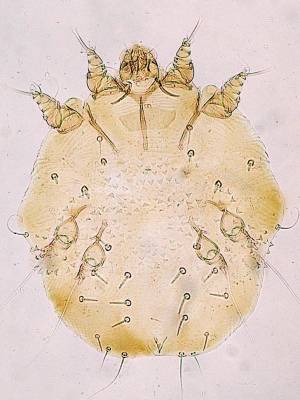 Sarcoptes sabiei