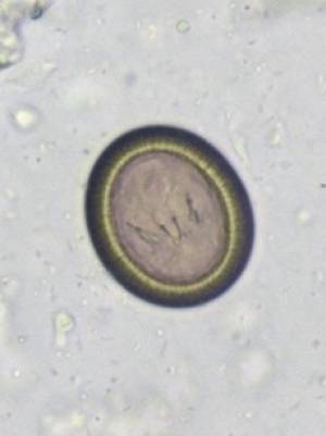 parasiten_taenia_spp._pritt_2016_.jpg