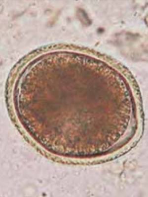 parasiten_toxocara_cati_pritt_2016_.jpg