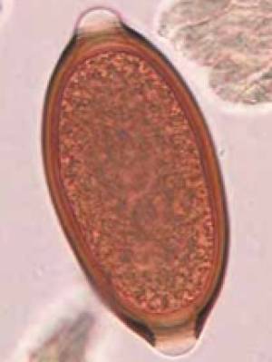 parasiten_trichuris_vulpis_quelle_unbekannt_.jpg