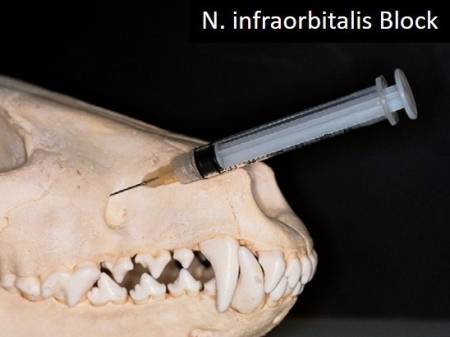 zahnmedizin_-_nervenblock_n._infraorbitalis_gorrel_2004_.jpg
