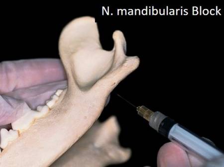 zahnmedizin_-_nervenblock_n._mandibularis_extraorbital_gorrel_2004_.jpg