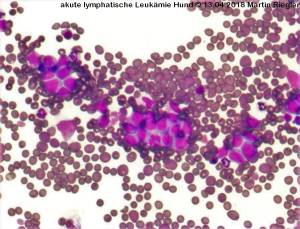 zytologie_lymphatische_leukaemie_m2_2016_.jpg