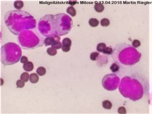 zytologie_malignitaetskriterien_1_m2_2014_.jpg