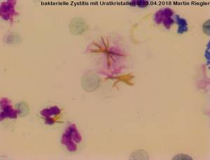 zytologie_zystitis_uratkristalle_kokken_m2_2014_.jpg