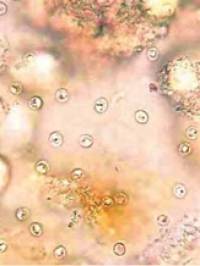 parasiten_cryptosporidium_spp._quelle_unbekannt_.jpg parasiten_cryptosporidium_spp._quelle_unbekannt_.jpg