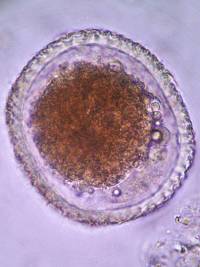 parasiten_toxocara_canis_pritt_2016_.jpg parasiten_toxocara_canis_pritt_2016_.jpg