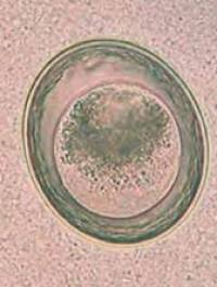 parasiten_toxascaris_leonina_quelle_unbekannt_.jpg parasiten_toxascaris_leonina_quelle_unbekannt_.jpg