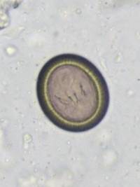 parasiten_taenia_spp._pritt_2016_.jpg parasiten_taenia_spp._pritt_2016_.jpg