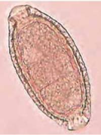 parasiten_capilaria_plica_quelle_unbekannt_.jpg parasiten_capilaria_plica_quelle_unbekannt_.jpg