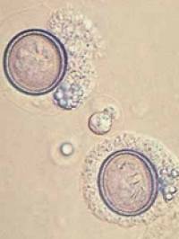 parasiten_echinococcus_spp._quelle_unbekannt_.jpg parasiten_echinococcus_spp._quelle_unbekannt_.jpg