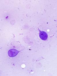 parasiten_giardien_pritt_b_2018_.jpg parasiten_giardien_pritt_b_2018_.jpg