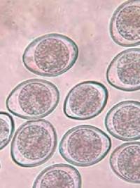 parasiten_isospora_spp._quelle_unbekannt_.jpg parasiten_isospora_spp._quelle_unbekannt_.jpg