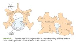 orthopaedie_-_bsv_hansen-typ-1_fossum_2013_.jpg orthopaedie_-_bsv_hansen-typ-1_fossum_2013_.jpg