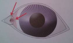 ophthalmologie-nasalekanthusplastikpauli_1.jpg ophthalmologie-nasalekanthusplastikpauli_1.jpg