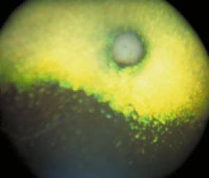 ophthalmologie-prafundus1.jpg ophthalmologie-prafundus1.jpg