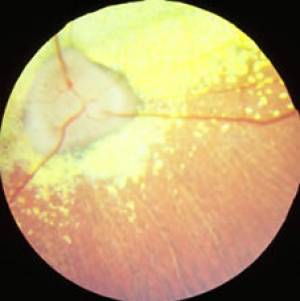 opthalmologie-prafundus.jpg opthalmologie-prafundus.jpg