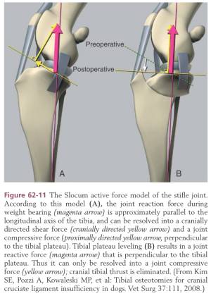TPLO - Kräfteparallelogramm (Tobias & Johnston, 2012) TPLO - Kräfteparallelogramm (Tobias & Johnston, 2012)