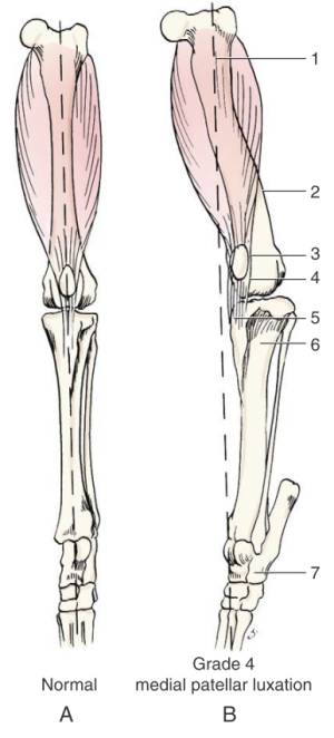 patellaluxation_pathologie_decamp_et_al._2016_.jpg patellaluxation_pathologie_decamp_et_al._2016_.jpg