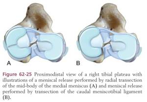 Meniscus-Release (Tobias & Johnston, 2012) Meniscus-Release (Tobias & Johnston, 2012)