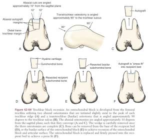 patellaluxation_blockosteotomie_tobias_johnston_2012_.jpg patellaluxation_blockosteotomie_tobias_johnston_2012_.jpg
