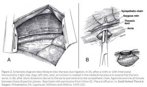 ductus_thoracicus_op_1_orton_1995_.jpg ductus_thoracicus_op_1_orton_1995_.jpg