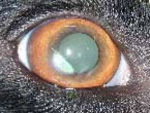 ophthalmologie-stromalehornhautdystrophiepauli.jpg ophthalmologie-stromalehornhautdystrophiepauli.jpg