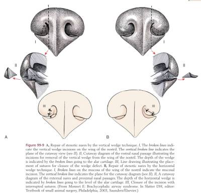 op_nasenloecher_erweitern_tobias_johnston_2012_.jpg op_nasenloecher_erweitern_tobias_johnston_2012_.jpg