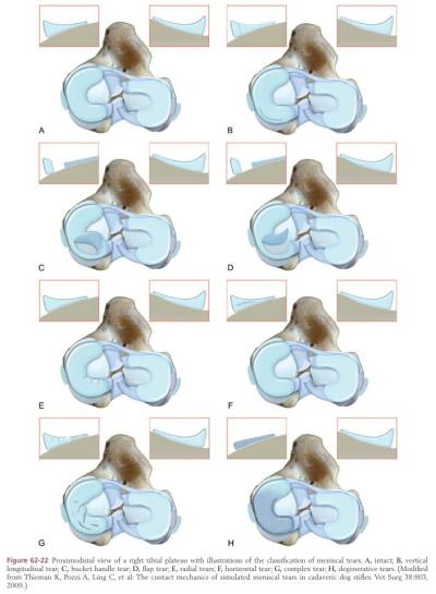 meniscus_schaden_tobias_johnston_2012_.jpg meniscus_schaden_tobias_johnston_2012_.jpg