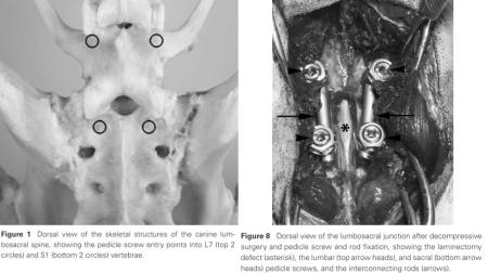 neurochirurgie_-_ces_stabilisierung_3_smolders_et_al._2010_.jpg neurochirurgie_-_ces_stabilisierung_3_smolders_et_al._2010_.jpg
