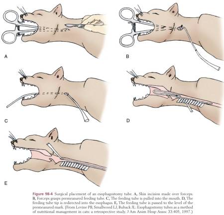 op_-_nasenschlund-sonde_tobias_2013_.jpg op_-_nasenschlund-sonde_tobias_2013_.jpg