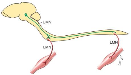 neurologie_-_unteres_und_oberes_motoneuron_sharp_wheeler_2005_.jpg neurologie_-_unteres_und_oberes_motoneuron_sharp_wheeler_2005_.jpg